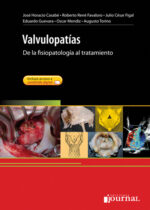 Valvulopatías