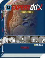 Expert DDX Abdomen