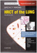 Specialty Imaging: HRCT of the Lung