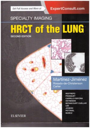 Specialty Imaging: HRCT of the Lung