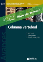 Avances en Diagnóstico por Imágenes: Columna vertebral E-Book