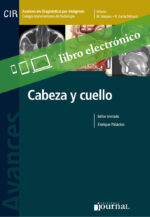 Avances en Diagnóstico por Imágenes: Cabeza y cuello E-Book