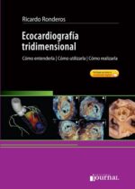 Ecocardiografía Tridimensional. Cómo entenderla, cómo utilizarla, cómo realizarla.
