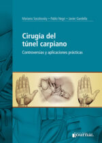 Cirugía del túnel carpiano, controversias y aplicaciones prácticas - Socolovski