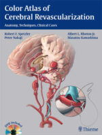Color Atlas of Cerebral Revascularization Anatomy, Techniques, Clinical Cases