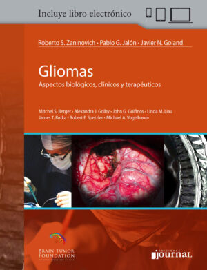 Gliomas: Aspectos biológicos, clínicos y terapéuticos - Zaninovich