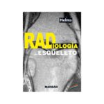 Radiología del Esqueleto