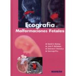 Ecografía en Malformaciones Fetales - Nyberg