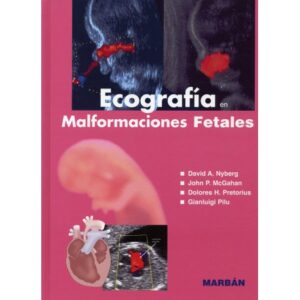 Ecografía en Malformaciones Fetales - Nyberg