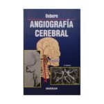 Angiografía Cerebral