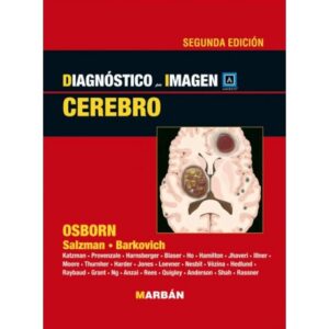 Diagnóstico por Imagen Cerebro