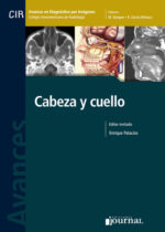 Avances en Diagnóstico por Imágenes: Cabeza y cuello