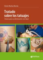 Tratado sobre tatuajes: claves para su eliminación con láser - Muñoz