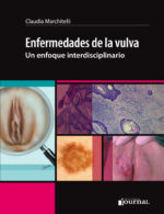 Enfermedades de la vulva: Un enfoque interdisciplinario