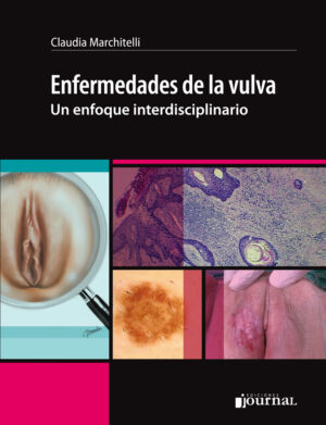 Enfermedades de la vulva: Un enfoque interdisciplinario