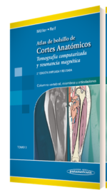 Atlas de Bolsillo de Cortes Anatómicos Tomo 3. Tomografía computarizada y resonancia magnética: Columna vertebral, Miembros y Articulaciones - Moller