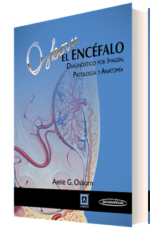 El Encéfalo Diagnóstico por imagen, patología y anatomía