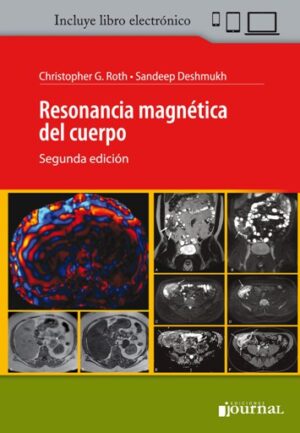 Resonancia Magnética del Cuerpo - Roth