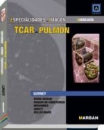 TCAR de Pulmón Especialidades en Imagen