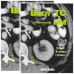 Body TC con correlación RM 2 Vols