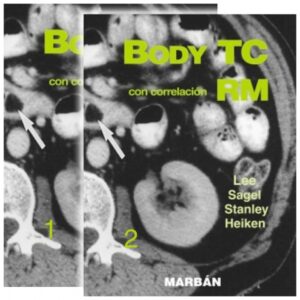 Body TC con correlación RM 2 Vols