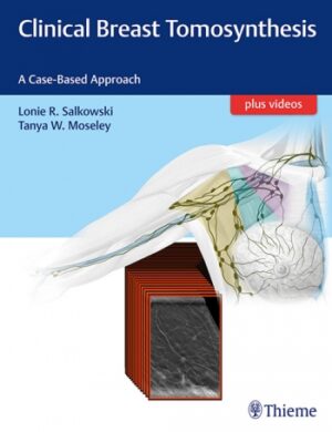 Clinical Breast Tomosynthesis - Salkowski