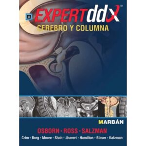 Expert DDX Cerebro y Columna