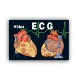 ECG Electrocardiografía