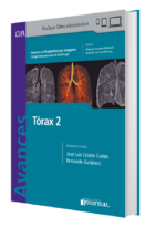 Tórax 2 Avances en Diagnóstico por imágenes Cir - Criales