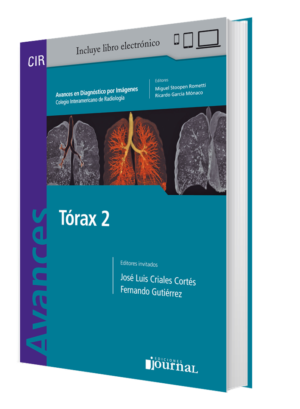 Tórax 2 Avances en Diagnóstico por imágenes Cir - Criales
