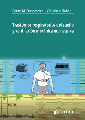 Trastornos respiratorios del sueño y ventilación mecánica no invasiva - Franceschini