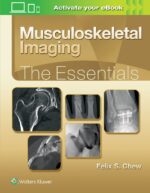 Musculoskeletal Imaging: The Essentials - Chew
