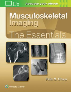 Musculoskeletal Imaging: The Essentials - Chew