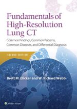 Fundamentals of High-Resolution Lung CT - Elicker