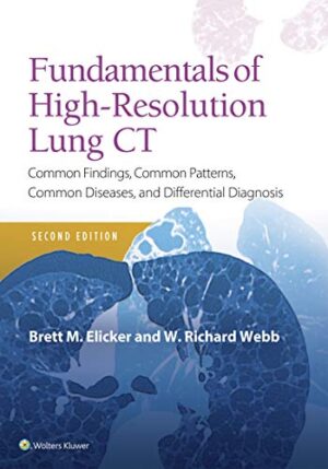 Fundamentals of High-Resolution Lung CT - Elicker