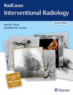 Radcases Interventional Radiology