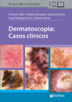 Dermatoscopia: Casos clínicos - Cabo