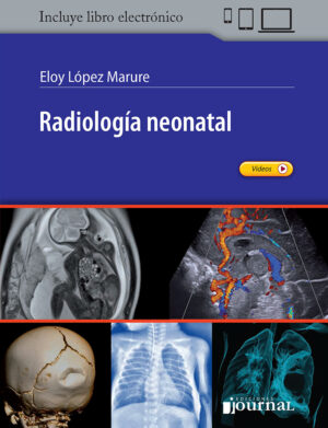 Radiología neonatal - López