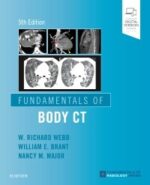Fundamentals of Body CT, 5th Edition - Webb