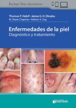 Enfermedades de la piel Diagnóstico y tratamiento - Habif