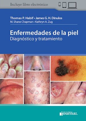 Enfermedades de la piel Diagnóstico y tratamiento - Habif