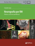 Neurografía por RM Plexos y nervios periféricos - Cejas