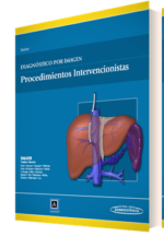 Diagnóstico por Imagen Procedimientos intervencionistas - Walker