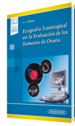 Ecografía Transvaginal en la Evaluación de los Tumores de Ovario (incluye versión digital)