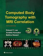 Computed Body Tomography with MRI Correlation - Lee
