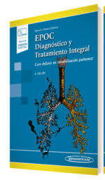 EPOC. Diagnóstico y Tratamiento Integral (Incluye versión digital)