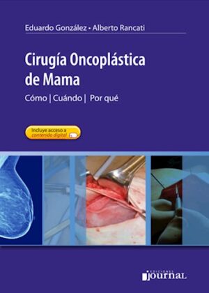 Cirugía Oncoplástica de Mama, Cúando / Cómo / Por qué - González