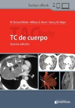 TC de cuerpo Ed.5º - Webb