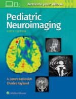 Pediatric Neuroimaging
