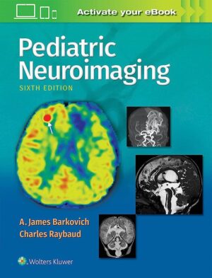 Pediatric Neuroimaging